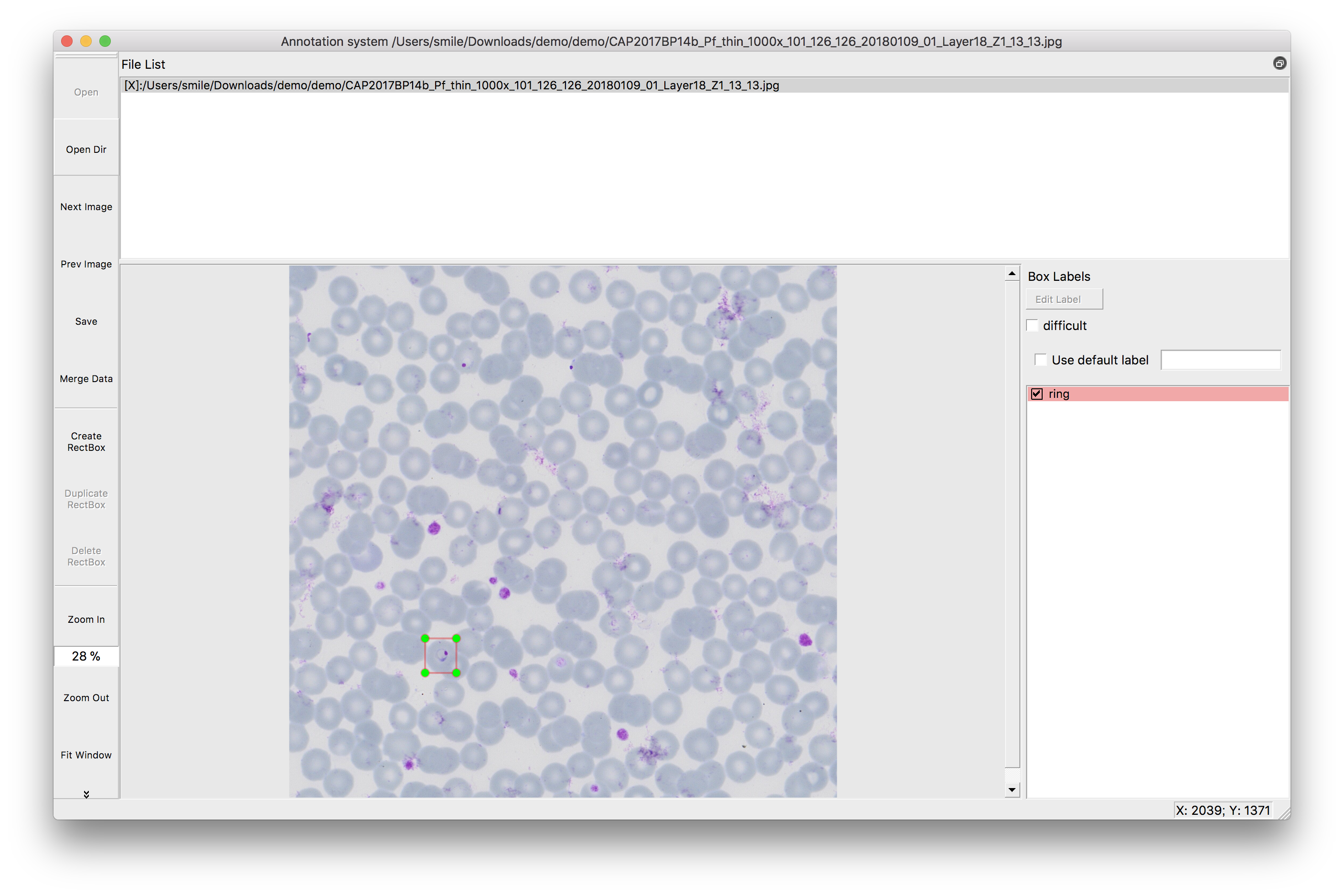 AI Labs released an annotation system: Long live the medical diagnosis ...